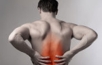 Как победить остеохондроз: лечение спины