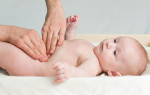 Как проводят лечение пупочной грыжи у новорожденных?
