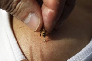 Грижа: лечение пчелами как терапия