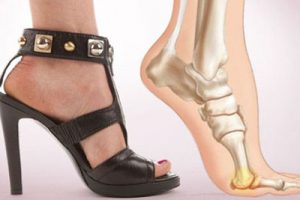 Остеохондроз пальца ноги: причини, диагностика и лечение