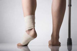 травмирование ноги