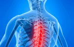 Как распознать грудной остеохондроз: симптоматика и лечение